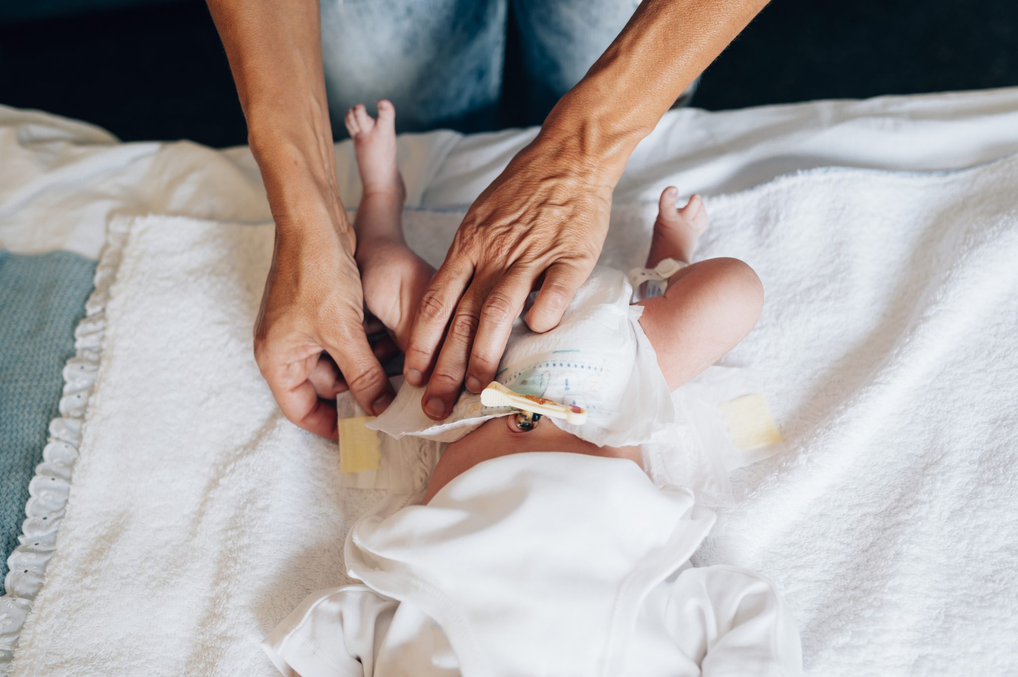 coto umbilical do bebê